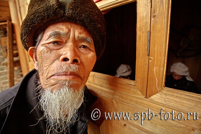 Катаракта на глазу пожилого китайца, фотоснимок